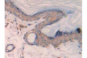 Used in DAB staining on fromalin fixed paraffin- embedded skeletal muscle tissue (CCL4 antibody  (AA 24-92))
