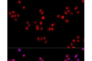 Immunofluorescence analysis of HeLa cells using ESRRA Polyclonal Antibody at dilution of 1:100. (ESRRA antibody)