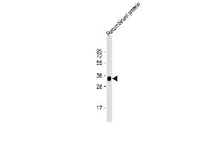 Anti-LRP1B Antibody at 1:2000 dilution + Recombinant protein Lysates/proteins at 20 μg per lane. (LRP1B antibody  (AA 2620-2891))