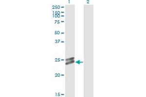 Western Blot analysis of OIP5 expression in transfected 293T cell line by OIP5 monoclonal antibody (M01), clone 3G10-1D5. (OIP5 antibody  (AA 1-229))