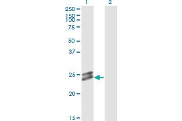 OIP5 antibody  (AA 1-229)