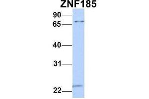 Host:  Rabbit  Target Name:  ZNF185  Sample Type:  MCF7  Antibody Dilution:  1. (Zinc Finger Protein 185 antibody  (N-Term))