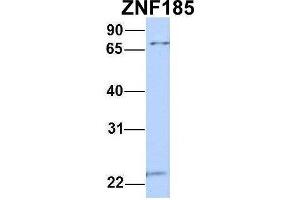 Host:  Rabbit  Target Name:  ZNF185  Sample Type:  MCF7  Antibody Dilution:  1. (Zinc Finger Protein 185 antibody  (N-Term))