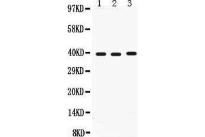 Anti-Midkine antibody, Western blotting All lanes: Anti Midkine  at 0. (Midkine antibody  (AA 21-143))
