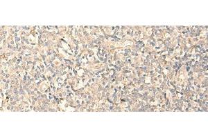 Immunohistochemistry of paraffin-embedded Human tonsil tissue using MPPED2 Polyclonal Antibody at dilution of 1:25(x200) (MPPED2 antibody)