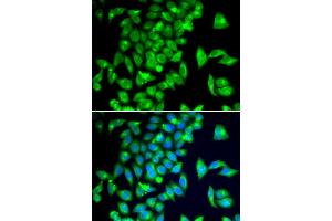 Immunofluorescence analysis of A549 cells using TPH2 antibody (ABIN5974298).