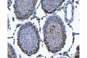 IHC analysis of SAP130 using anti-SAP130 antibody (ABIN7601247). (SAP130 antibody  (AA 309-913))