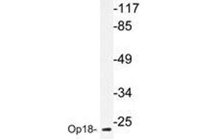 Western blot analyzes of Op18 antibody in extracts from COLO205 cells. (Stathmin 1 antibody)