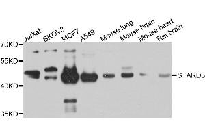 Western blot analysis of extracts of various cells, using STARD3 antibody. (STARD3 antibody)