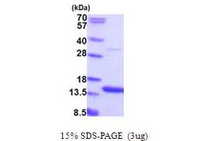 Adipogenesis Associated Mth938 Domain Containing (AAMDC) (AA 1-122) protein (His tag)