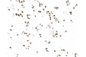 Immunocytochemistry (ICC) image for anti-Paired Box 8 (PAX8) antibody (ABIN7795602) (PAX8 antibody)