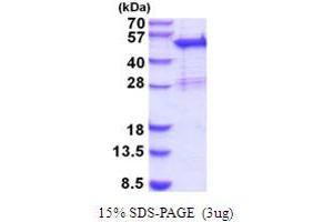 SDS-PAGE (SDS) image for Sorting Nexin 5 (SNX5) (AA 1-404) protein (His tag) (ABIN5854205) (SNX5 Protein (AA 1-404) (His tag))