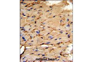 Formalin-fixed and paraffin-embedded mouse heart tissue reacted with PEA-15 Antibody , which was peroxidase-conjugated to the secondary antibody, followed by DAB staining. (PEA15 antibody  (C-Term))