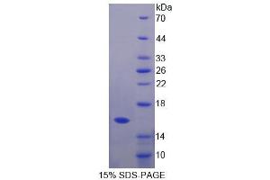 SDS-PAGE analysis of Mouse GHRH Protein. (GHRH Protein)