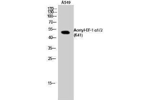 Western Blotting (WB) image for anti-Eukaryotic Translation Elongation Factor 1 Alpha1/Alpha2 (EF-1 Alpha1/2) (acLys41) antibody (ABIN3180430) (EF-1 Alpha1/2 antibody  (acLys41))