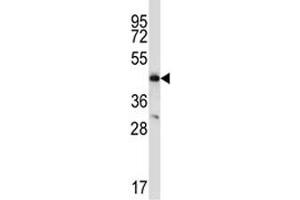 CCR9 antibody western blot analysis in MDA-MB435 lysate (CCR9 antibody  (AA 306-334))