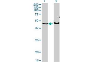 Western Blot analysis of PKNOX1 expression in transfected 293T cell line by PKNOX1 monoclonal antibody (M05), clone 2B3. (PKNOX1 antibody  (AA 2-100))