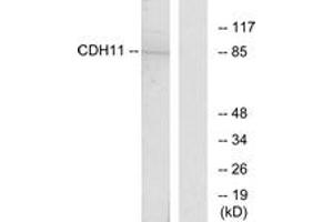 Western Blotting (WB) image for anti-Cadherin 11 (CDH11) (AA 421-470) antibody (ABIN2889874) (OB Cadherin antibody  (AA 421-470))