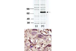 Image no. 2 for anti-Bruton Agammaglobulinemia tyrosine Kinase (BTK) (Middle Region) antibody (ABIN359974) (BTK antibody  (Middle Region))