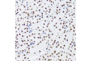 Immunohistochemistry (Paraffin-embedded Sections) (IHC (p)) image for anti-Nuclear Factor of kappa Light Polypeptide Gene Enhancer in B-Cells 2 (NFKB2) (AA 690-899) antibody (ABIN3017388)