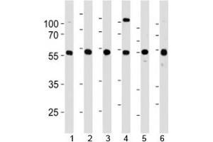 YY1 antibody western blot analysis in 1) 293, 2) HL-60, 3) SiHa, 4) K562, 5) THP-1 and 6) U266 lysate. (YY1 antibody  (AA 74-104))