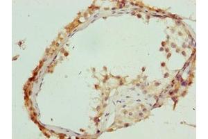 Immunohistochemistry of paraffin-embedded human testis tissue using ABIN7174755 at dilution of 1:100 (C17orf64 antibody  (AA 111-236))