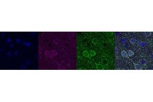 Immunohistochemistry (IHC) image for anti-Ubiquitin Carboxyl-terminal Esterase L1 (Ubiquitin Thiolesterase) (UCHL1) antibody (ABIN7456063) (UCHL1 antibody)