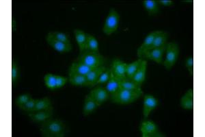 Immunofluorescence staining of HepG2 cells with ABIN7160369 at 1:133, counter-stained with DAPI.