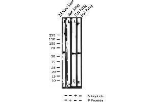 Western Blotting (WB) image for anti-Peroxisome Proliferator-Activated Receptor gamma (PPARG) (pSer112) antibody (ABIN6256109)