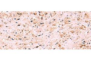 anti-Zinc Finger, SWIM-Type Containing 1 (ZSWIM1) antibody