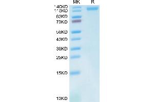 LDLR Protein (AA 22-788) (His tag)
