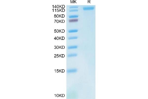 LDLR Protein (AA 22-788) (His tag)