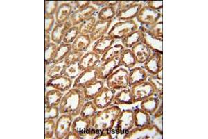DEGS2 antibody immunohistochemistry analysis in formalin fixed and paraffin embedded human kidney tissue followed by peroxidase conjugation of the secondary antibody and DAB staining. (DEGS2 antibody  (C-Term))
