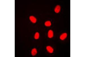 Immunofluorescent analysis of ERK3 staining in HeLa cells. (MAPK6 antibody  (Center))