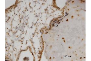 Immunoperoxidase of monoclonal antibody to OLIG2 on formalin-fixed paraffin-embedded human placenta. (OLIG2 antibody  (AA 2-78))