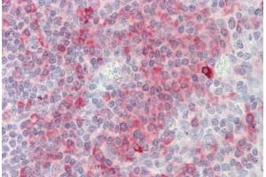 Human Tonsil: Formalin-Fixed, Paraffin-Embedded (FFPE) (SH2D1A antibody  (C-Term))