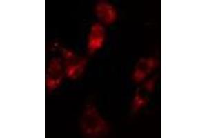 ABIN6279766 staining Hela cells by IF/ICC. (ARHGAP12 antibody  (Internal Region))