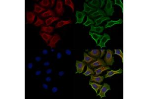ABIN6257930 and ABIN6274821 staining Hela cells by IF/ICC. (AGXT2L2 antibody  (C-Term))