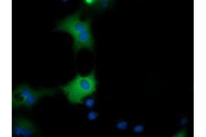 Anti-QPRT mouse monoclonal antibody (ABIN2453570) immunofluorescent staining of COS7 cells transiently transfected by pCMV6-ENTRY QPRT (RC202960). (QPRT antibody)