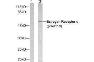 Western blot analysis of extracts from MCF7 using Estrogen Receptor-α (phospho-Ser118) antibody (E011072). (Estrogen Receptor alpha antibody  (pSer118))