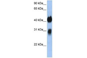 WB Suggested Anti-OTX1 Antibody Titration:  0. (OTX1 antibody  (C-Term))