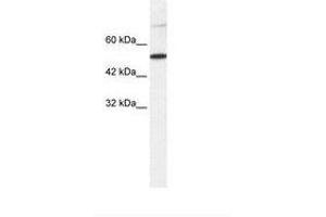Image no. 1 for anti-T-Box 3 (TBX3) (AA 404-453) antibody (ABIN203221) (TBX3 antibody  (AA 404-453))