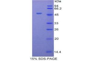 SDS-PAGE (SDS) image for Orosomucoid 1 (ORM1) (AA 33-195) protein (His tag,GST tag) (ABIN2122371)