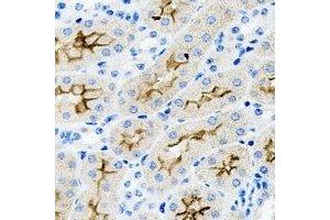 Immunohistochemical analysis of PAR6A staining in rat kidney formalin fixed paraffin embedded tissue section. (PARD6A antibody)
