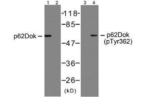 Western blot analysis of extracts from Jurkat cells, using p62Dok (Ab-362) antibody (E021268, Line 1 and 2) and p62Dok (phospho-Tyr362) antibody (E011276, Line 3 and 4). (DOK1 antibody  (pTyr362))