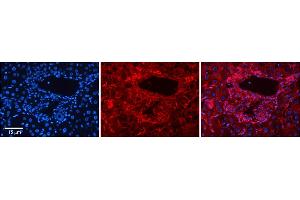 Rabbit Anti-SLC26A1 Antibody  Catalog Number: ARP44029_P050 Formalin Fixed Paraffin Embedded Tissue: Human Adult Liver  Observed Staining: Membrane in hepatocytes; Membrane and Cytoplasm in cells of the portal vein, hepatic arteries and bile ducts, strong signal, wide tissue distribution Primary Antibody Concentration: 1:100 Secondary Antibody: Donkey anti-Rabbit-Cy3 Secondary Antibody Concentration: 1:200 Magnification: 20X Exposure Time: 0. (SLC26A1 antibody  (Middle Region))