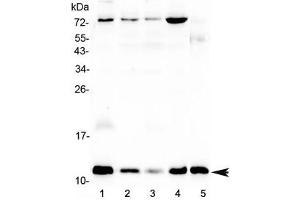 Western blot testing of human 1) U-87 MG, 2) MCF7, 3) A549, 4) HepG2 and 5) mouse testis lysate with DYNLT1 antibody at 0. (DYNLT1 antibody)