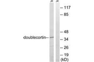 Western Blotting (WB) image for anti-Doublecortin (DCX) (AA 346-395) antibody (ABIN1533167)