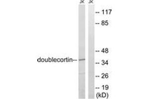 Western blot analysis of extracts from Jurkat cells, using Doublecortin (Ab-376) Antibody.