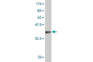 Western Blot detection against Immunogen (37. (Transglutaminase 7 antibody  (AA 466-565))